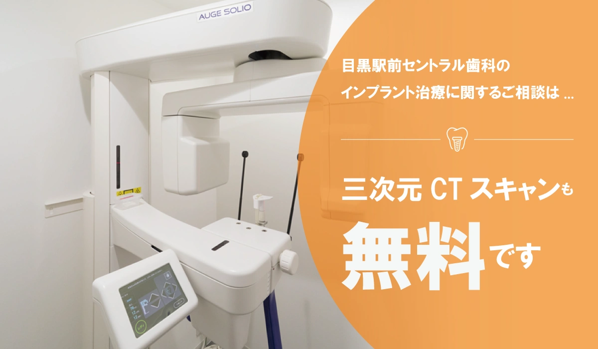 歯の欠損にインプラント治療。土日診療OK、無料カウンセリング受付中